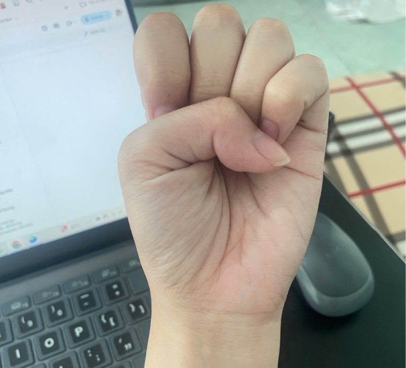Bước 1: Chụp lại hình ảnh bàn tay của bạn